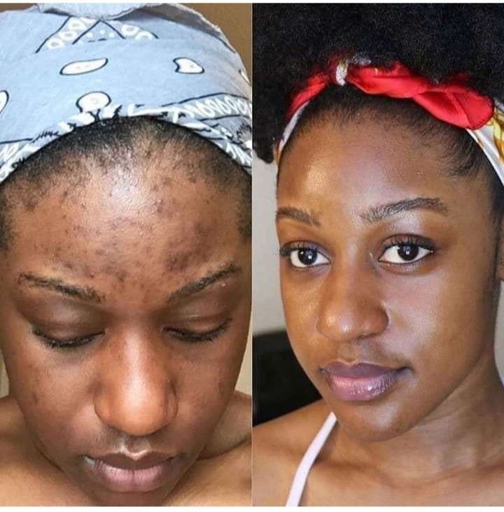 How To Get Rid Of Dark Spots On Your Arms